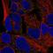 TOR antibody, NBP2-55920, Novus Biologicals, Immunocytochemistry image 