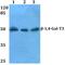 Beta-1,4-Galactosyltransferase 3 antibody, PA5-36434, Invitrogen Antibodies, Western Blot image 