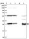 Sepiapterin Reductase antibody, NBP1-87060, Novus Biologicals, Western Blot image 
