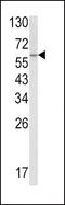 Sterol Carrier Protein 2 antibody, MBS9208507, MyBioSource, Western Blot image 