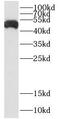 Colony Stimulating Factor 2 Receptor Alpha Subunit antibody, FNab02013, FineTest, Western Blot image 