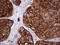 Keratin 16 antibody, LS-C791607, Lifespan Biosciences, Immunohistochemistry paraffin image 