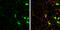 Discs Large MAGUK Scaffold Protein 3 antibody, GTX133211, GeneTex, Immunocytochemistry image 
