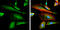 Protein Tyrosine Kinase 2 antibody, GTX129840, GeneTex, Immunocytochemistry image 