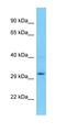 Uroplakin 3B Like 1 antibody, orb327183, Biorbyt, Western Blot image 