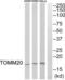 Translocase Of Outer Mitochondrial Membrane 20 antibody, abx014600, Abbexa, Western Blot image 