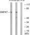 Glyceronephosphate O-Acyltransferase antibody, PA5-39135, Invitrogen Antibodies, Western Blot image 