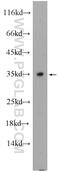 Testis Expressed 37 antibody, 25464-1-AP, Proteintech Group, Western Blot image 