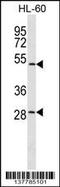 Zinc Finger Protein 324 antibody, 59-742, ProSci, Western Blot image 
