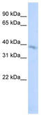 Transmembrane Protein 82 antibody, TA336096, Origene, Western Blot image 