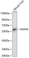 Hepatocyte Nuclear Factor 4 Alpha antibody, 15-313, ProSci, Western Blot image 