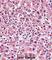 Alkaline Phosphatase, Placental antibody, abx027463, Abbexa, Western Blot image 