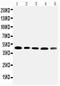 Serpin Family A Member 6 antibody, PA2230, Boster Biological Technology, Western Blot image 
