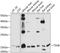 Thyroid Stimulating Hormone Subunit Beta antibody, A04304, Boster Biological Technology, Western Blot image 