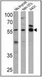 Thyroid Hormone Receptor Alpha antibody, PA1-216, Invitrogen Antibodies, Western Blot image 