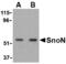 SKI Like Proto-Oncogene antibody, MBS151484, MyBioSource, Western Blot image 