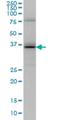 Ubiquitin Conjugating Enzyme E2 J1 antibody, H00051465-M01, Novus Biologicals, Western Blot image 