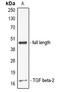 Transforming Growth Factor Beta 2 antibody, orb382630, Biorbyt, Western Blot image 