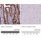 Cadherin 1 antibody, AMAb90862, Atlas Antibodies, Immunohistochemistry paraffin image 