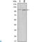Protein Tyrosine Kinase 2 antibody, LS-C812597, Lifespan Biosciences, Immunofluorescence image 