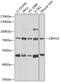 UTP4 Small Subunit Processome Component antibody, GTX66533, GeneTex, Western Blot image 