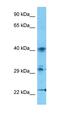Zinc Finger Protein 662 antibody, orb325613, Biorbyt, Western Blot image 