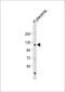 ADAM Metallopeptidase Domain 19 antibody, 64-129, ProSci, Western Blot image 