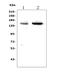 SUMO Specific Peptidase 6 antibody, A05088-3, Boster Biological Technology, Western Blot image 