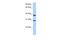 Kelch Domain Containing 1 antibody, A16271, Boster Biological Technology, Western Blot image 