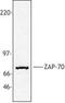 Zeta Chain Of T Cell Receptor Associated Protein Kinase 70 antibody, LS-C40875, Lifespan Biosciences, Western Blot image 