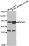 Interferon Gamma Receptor 2 antibody, A7558, ABclonal Technology, Western Blot image 
