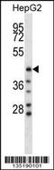 Hyaluronidase 1 antibody, 58-067, ProSci, Western Blot image 