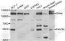 Prolyl 4-Hydroxylase, Transmembrane antibody, A6143, ABclonal Technology, Western Blot image 