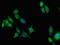 Amine Oxidase Copper Containing 3 antibody, orb401676, Biorbyt, Immunofluorescence image 