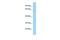 Acyl-CoA Synthetase Medium Chain Family Member 2A antibody, GTX16562, GeneTex, Western Blot image 