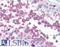 Tubulin Gamma 1 antibody, LS-B1496, Lifespan Biosciences, Immunohistochemistry frozen image 
