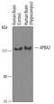 Amyloid Beta Precursor Protein Binding Family A Member 2 antibody, PA5-47830, Invitrogen Antibodies, Western Blot image 