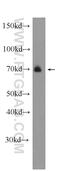ARK5 antibody, 22723-1-AP, Proteintech Group, Western Blot image 