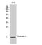 Galectin 1 antibody, STJ93201, St John