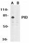 PID antibody, TA306072, Origene, Western Blot image 
