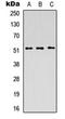 Protein Interacting With PRKCA 1 antibody, orb234937, Biorbyt, Western Blot image 