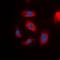 Insulin Receptor Substrate 1 antibody, orb315570, Biorbyt, Immunofluorescence image 