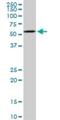 LXR beta antibody, H00007376-M03, Novus Biologicals, Western Blot image 