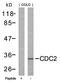 Cyclin Dependent Kinase 1 antibody, orb14552, Biorbyt, Western Blot image 