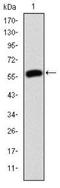 Junction Plakoglobin antibody, NBP2-37557, Novus Biologicals, Western Blot image 