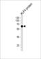 Kruppel Like Factor 4 antibody, LS-C96469, Lifespan Biosciences, Western Blot image 