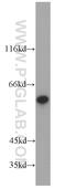 Citrin antibody, 10789-1-AP, Proteintech Group, Western Blot image 