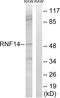 Ring Finger Protein 14 antibody, A08956, Boster Biological Technology, Western Blot image 