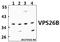 VPS26, Retromer Complex Component B antibody, A12325-1, Boster Biological Technology, Western Blot image 