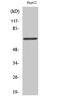 DEAD-Box Helicase 5 antibody, STJ94913, St John